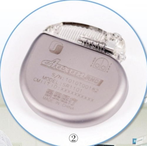 腦起搏器中國智造 景 色正濃 訪國產(chǎn)腦起搏器研發(fā)企業(yè)景昱醫(yī)療董事長寧益華
